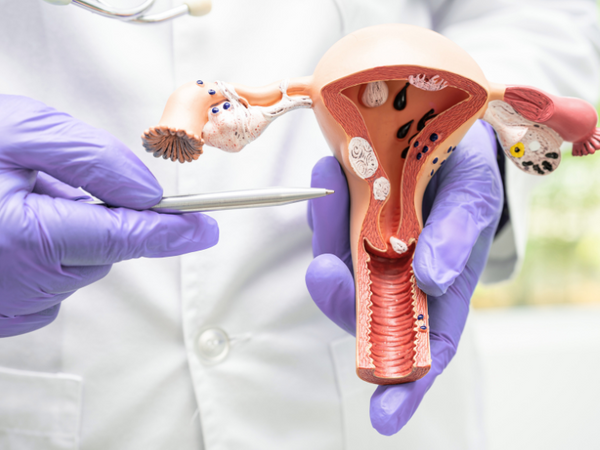 Endometrial+Cancer+(1).png